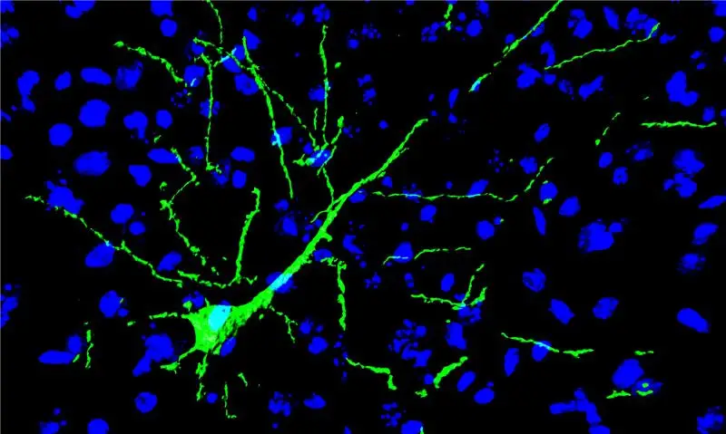 mouse neurons in brain