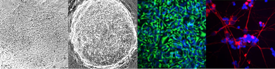 stem cell differentiation