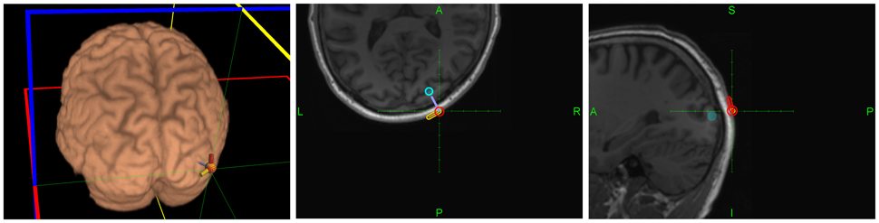 brain to brain communication