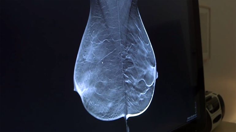 breast tomosynthesis future technology