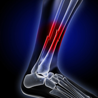 faster healing of bone injuries