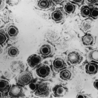herpes