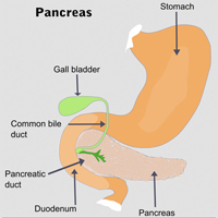pancreatic cancer diagram