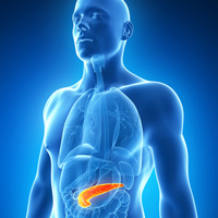 pancreatic cancer diagram