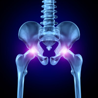 osteoporosis