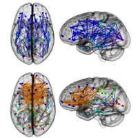 brain scans