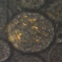 nanorods inside human cell