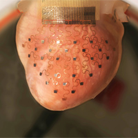 heart device