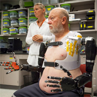 first man with two mind controlled prosthetic limbs