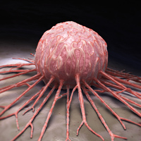 cancer