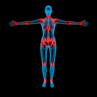 arthritis future cure
