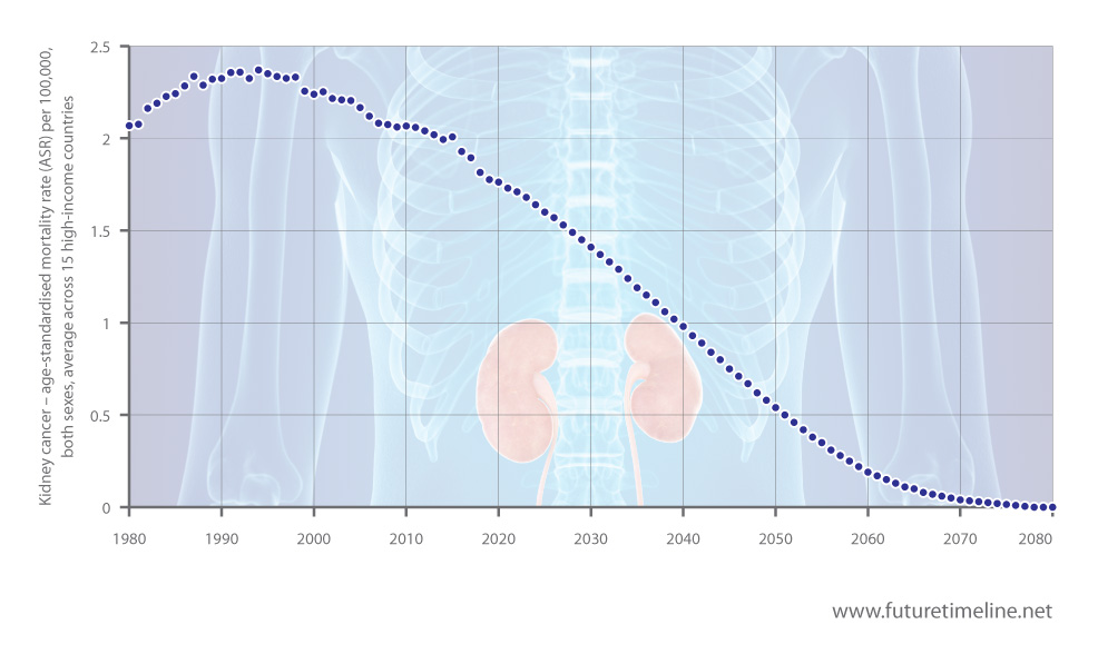 kidney cancer future timeline cure 2050 2100