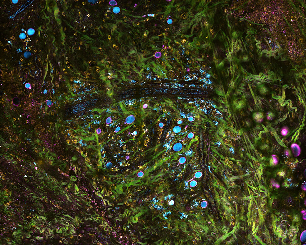 tissue imaging future technology gif