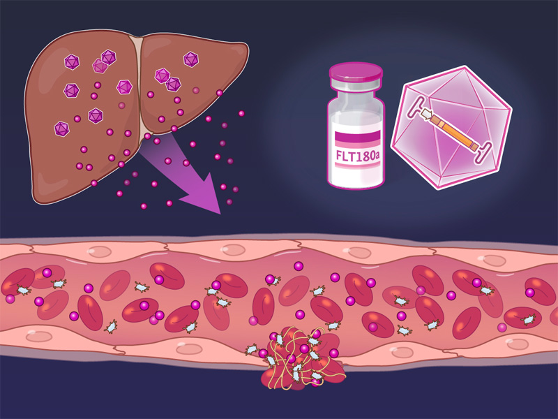 future cure for haemophilia B