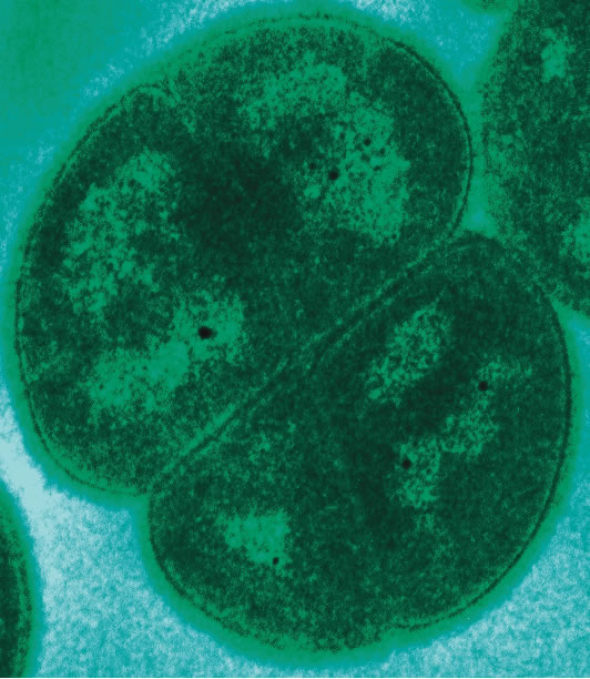 deinococcus radiodurans