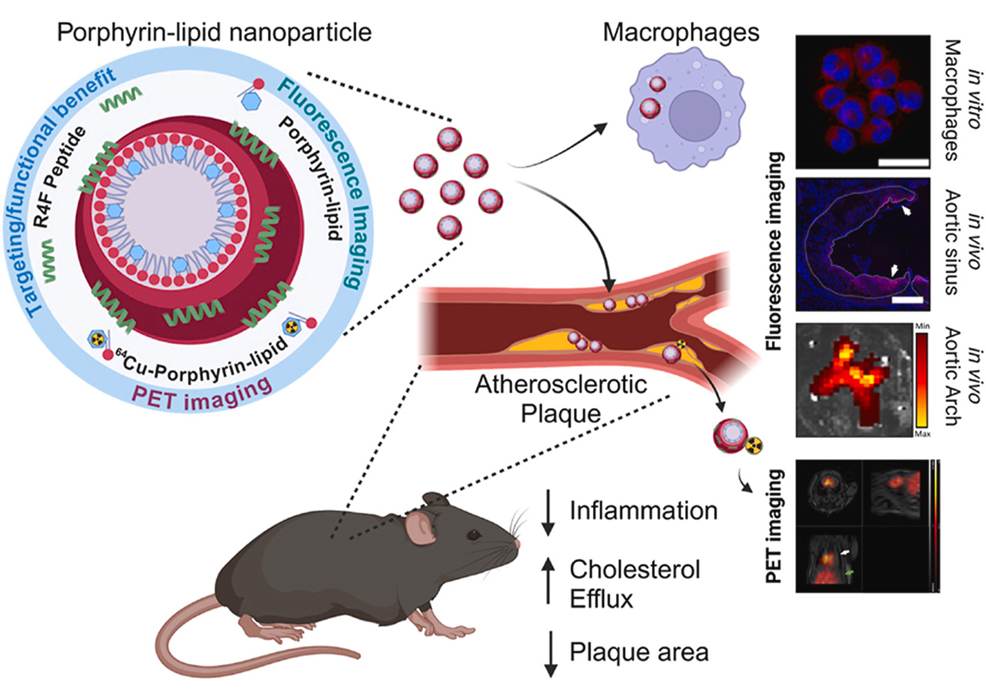 nanoparticles blood cells arterial plaque
